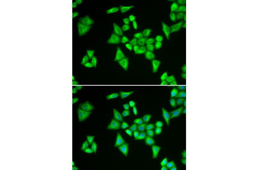 Immunofluorescence - ADSL antibody from Signalway Antibody (38788) - Antibodies.com