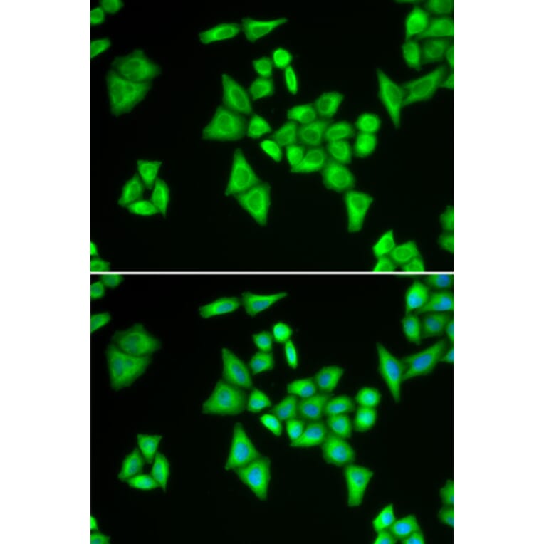 Immunofluorescence - ADSL antibody from Signalway Antibody (38788) - Antibodies.com