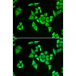 Immunofluorescence - ADSL antibody from Signalway Antibody (38788) - Antibodies.com