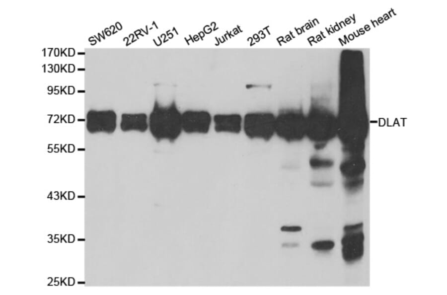 Western blot - DLAT antibody from Signalway Antibody (38796) - Antibodies.com