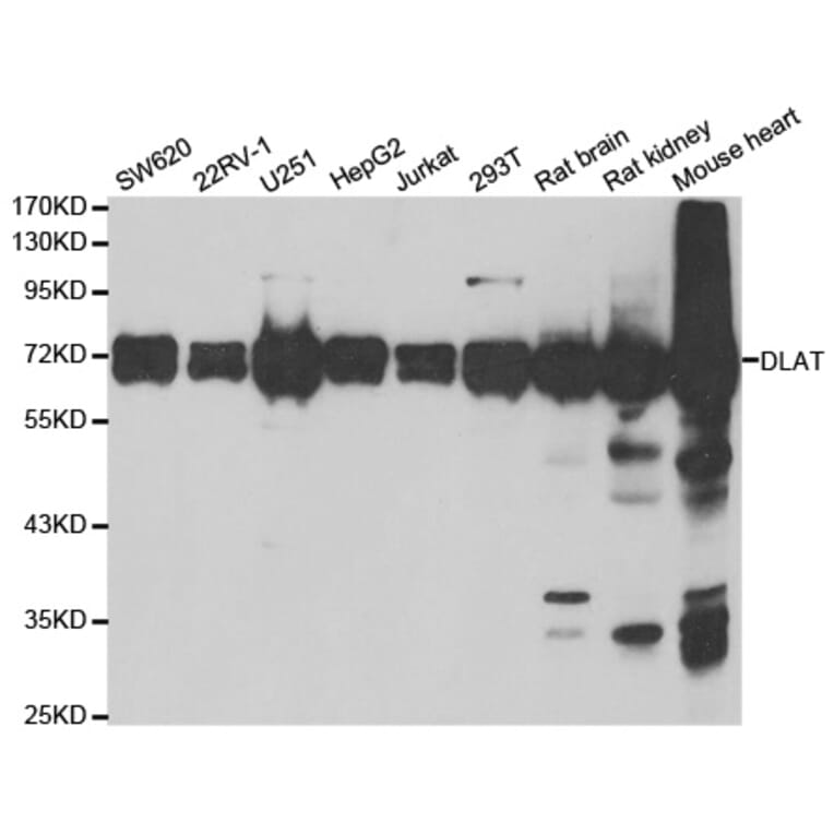 Western blot - DLAT antibody from Signalway Antibody (38796) - Antibodies.com