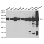 Western blot - DLAT antibody from Signalway Antibody (38796) - Antibodies.com