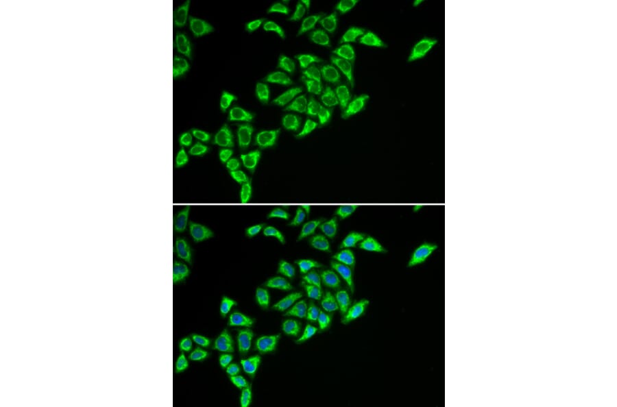 Immunofluorescence - DLAT antibody from Signalway Antibody (38796) - Antibodies.com