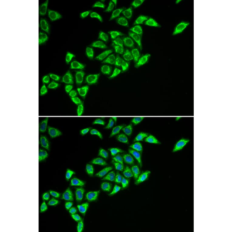 Immunofluorescence - DLAT antibody from Signalway Antibody (38796) - Antibodies.com