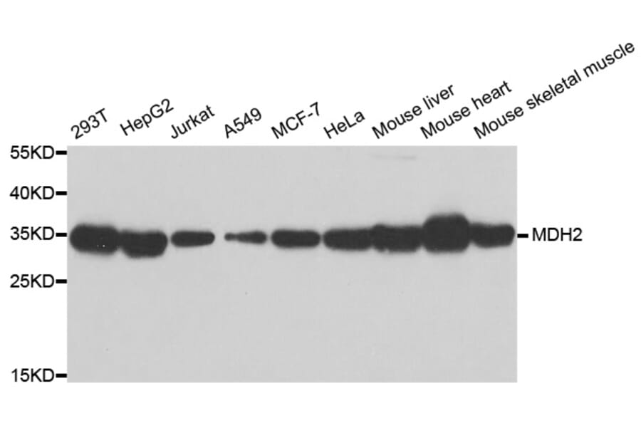 Western blot - MDH2 antibody from Signalway Antibody (38803) - Antibodies.com