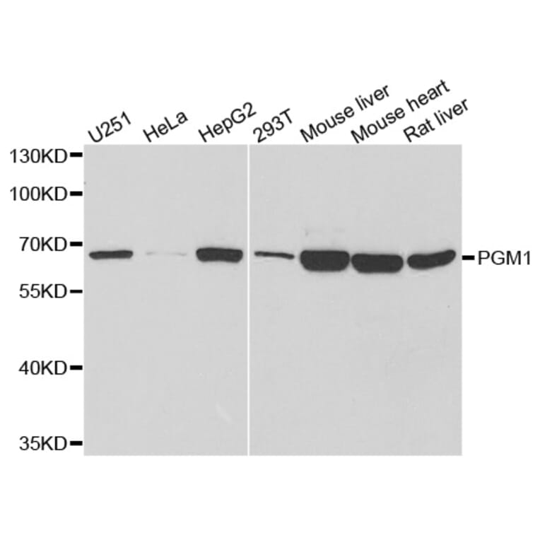 Western blot - PGM1 antibody from Signalway Antibody (38809) - Antibodies.com