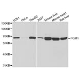 Western blot - PGM1 antibody from Signalway Antibody (38809) - Antibodies.com