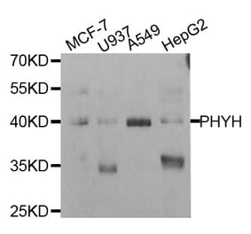 Western blot - PHYH antibody from Signalway Antibody (38810) - Antibodies.com