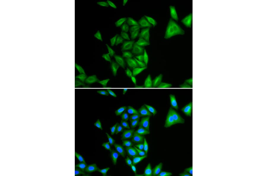 Immunofluorescence - PHYH antibody from Signalway Antibody (38810) - Antibodies.com