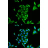 Immunofluorescence - PHYH antibody from Signalway Antibody (38810) - Antibodies.com