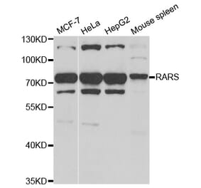 Western blot - RARS antibody from Signalway Antibody (38812) - Antibodies.com
