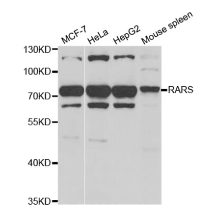 Western blot - RARS antibody from Signalway Antibody (38812) - Antibodies.com