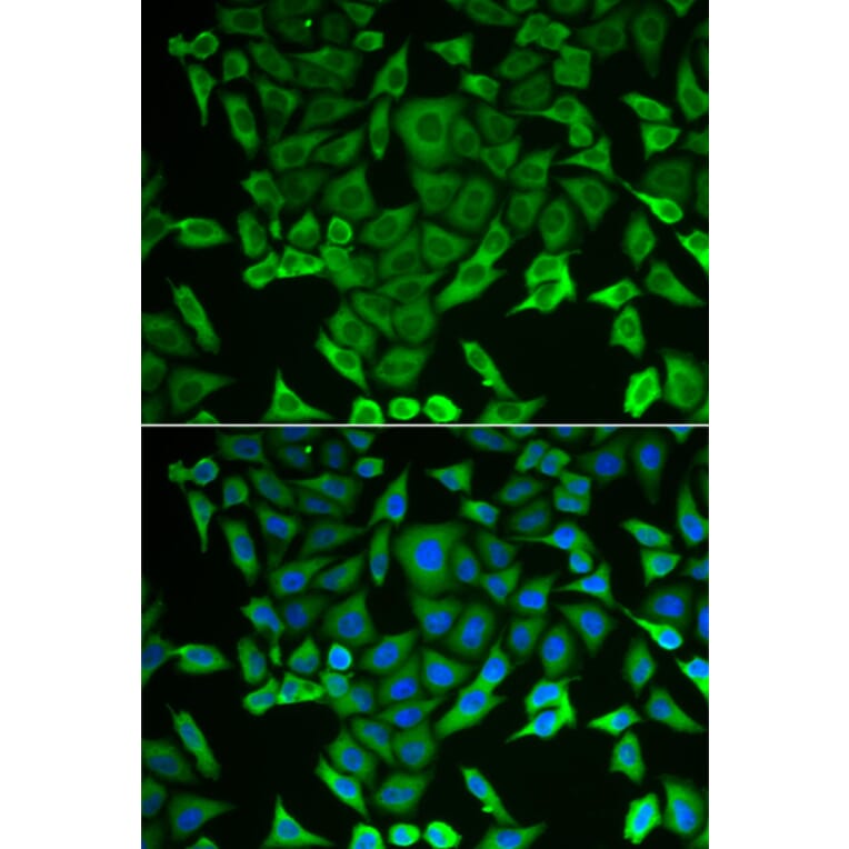 Immunofluorescence - RARS antibody from Signalway Antibody (38812) - Antibodies.com