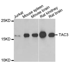 Western blot - TAC3 antibody from Signalway Antibody (38816) - Antibodies.com