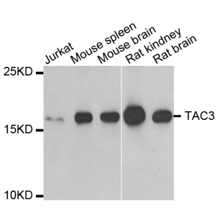 Western blot - TAC3 antibody from Signalway Antibody (38816) - Antibodies.com