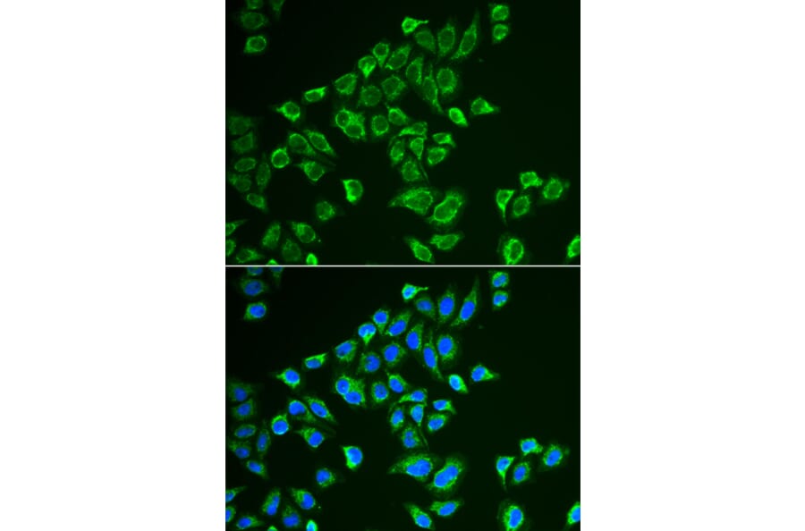 Immunofluorescence - TAC3 antibody from Signalway Antibody (38816) - Antibodies.com