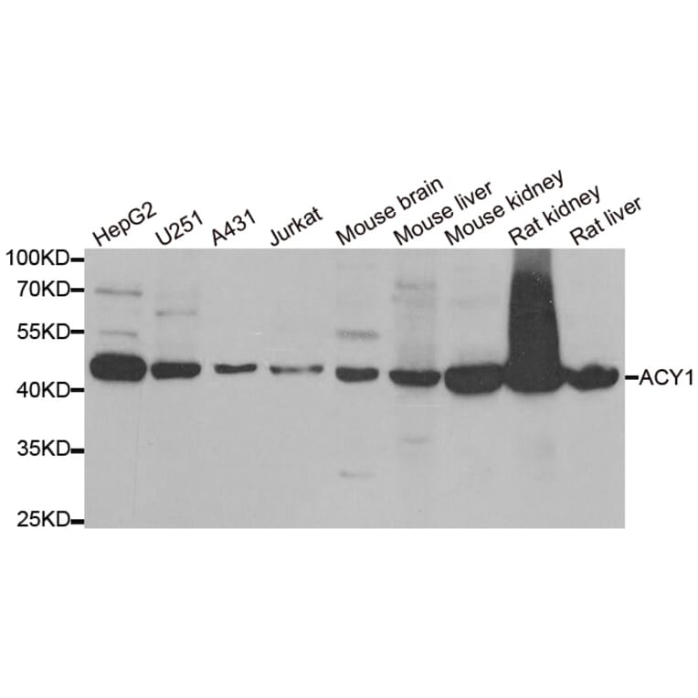 Western blot - ACY1 antibody from Signalway Antibody (38839) - Antibodies.com