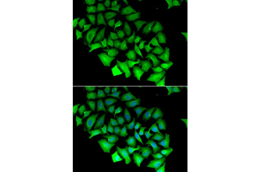 Immunofluorescence - ACY1 antibody from Signalway Antibody (38839) - Antibodies.com