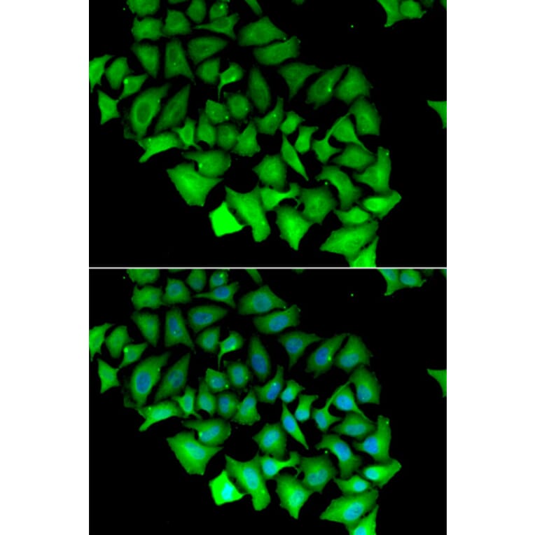 Immunofluorescence - ACY1 antibody from Signalway Antibody (38839) - Antibodies.com