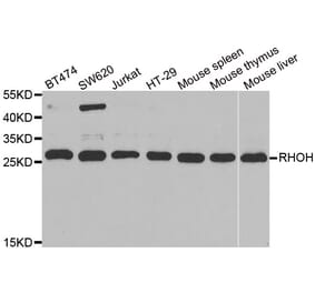 Western blot - RHOH antibody from Signalway Antibody (38843) - Antibodies.com