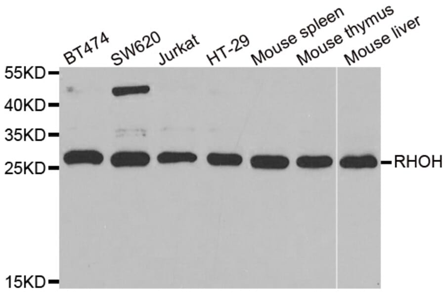 Western blot - RHOH antibody from Signalway Antibody (38843) - Antibodies.com
