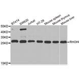 Western blot - RHOH antibody from Signalway Antibody (38843) - Antibodies.com