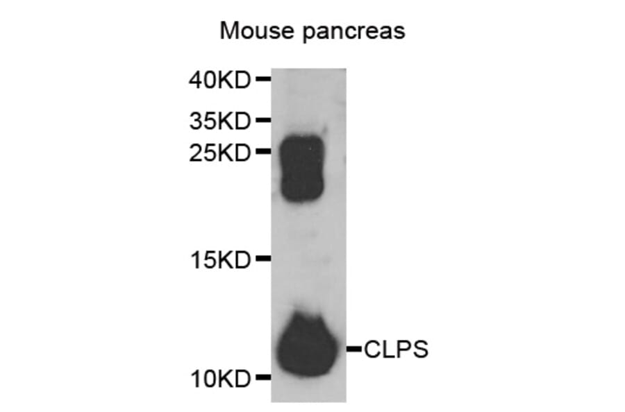 Western blot - CLPS antibody from Signalway Antibody (38849) - Antibodies.com
