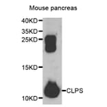 Western blot - CLPS antibody from Signalway Antibody (38849) - Antibodies.com