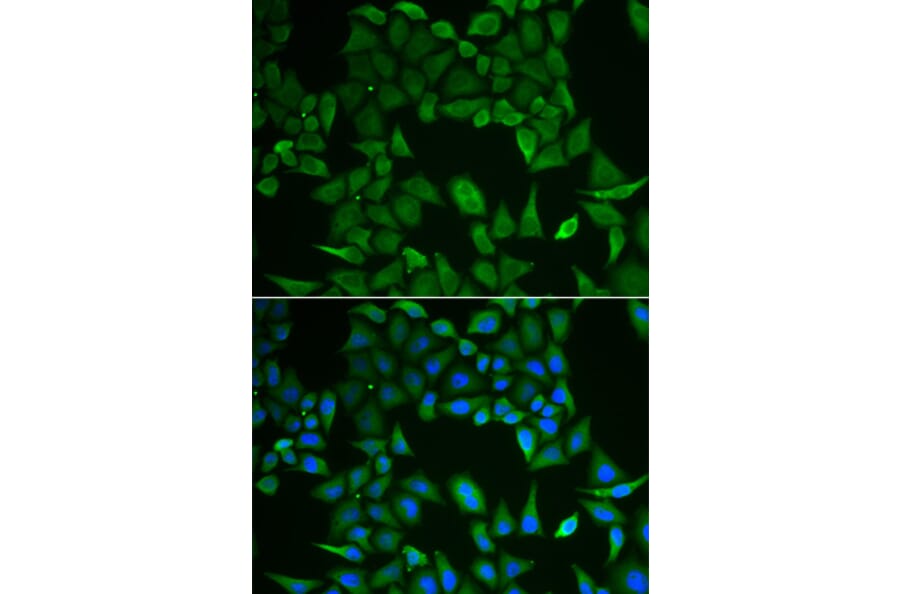 Immunofluorescence - CLPS antibody from Signalway Antibody (38849) - Antibodies.com