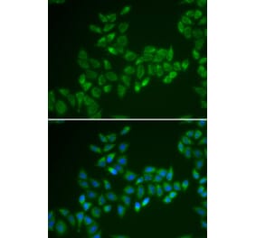 Immunofluorescence - CRAT antibody from Signalway Antibody (38850) - Antibodies.com