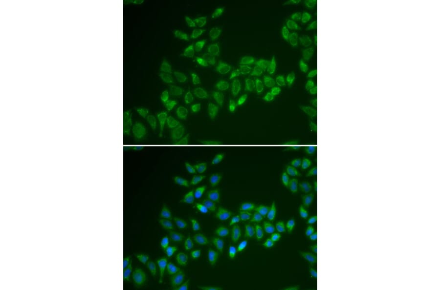 Immunofluorescence - CRAT antibody from Signalway Antibody (38850) - Antibodies.com