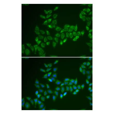 Immunofluorescence - CRAT antibody from Signalway Antibody (38850) - Antibodies.com