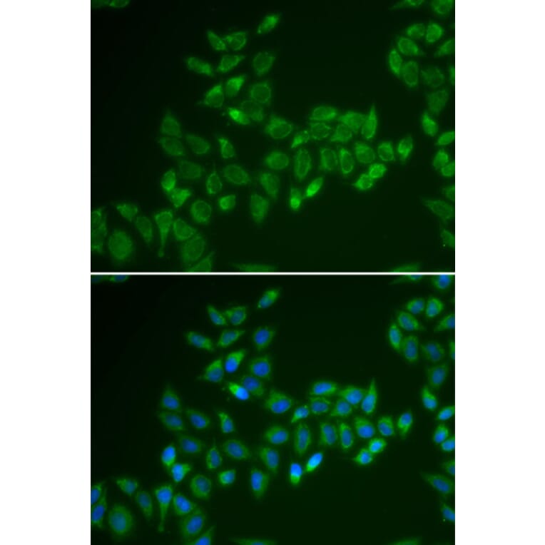 Immunofluorescence - CRAT antibody from Signalway Antibody (38850) - Antibodies.com