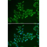 Immunofluorescence - CRAT antibody from Signalway Antibody (38850) - Antibodies.com