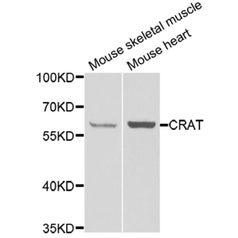 Western blot - CRAT antibody from Signalway Antibody (38850) - Antibodies.com