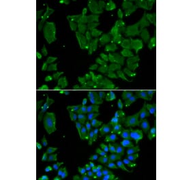 Immunofluorescence - DBN1 antibody from Signalway Antibody (38851) - Antibodies.com