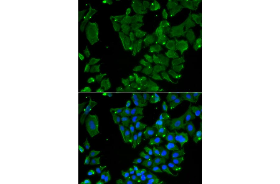 Immunofluorescence - DBN1 antibody from Signalway Antibody (38851) - Antibodies.com