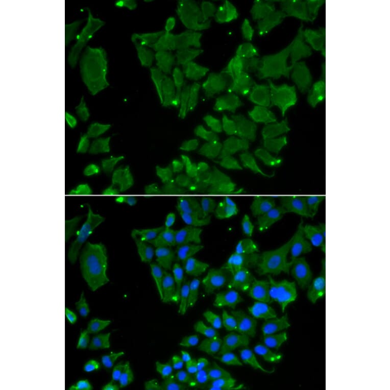 Immunofluorescence - DBN1 antibody from Signalway Antibody (38851) - Antibodies.com