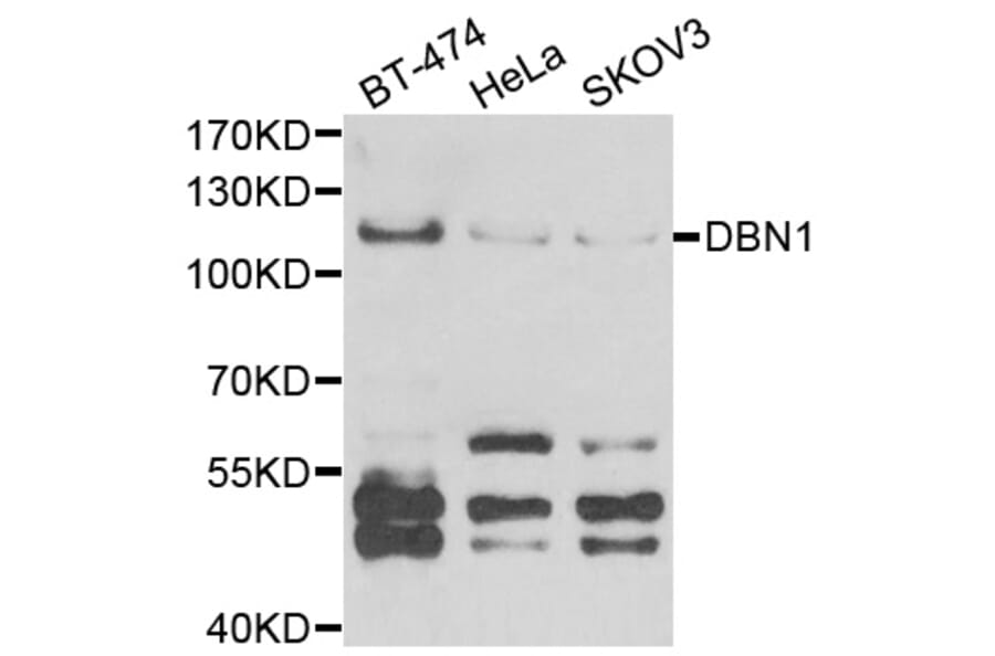 Western blot - DBN1 antibody from Signalway Antibody (38851) - Antibodies.com