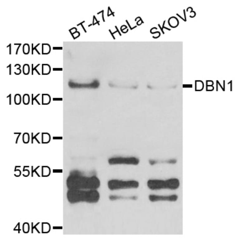 Western blot - DBN1 antibody from Signalway Antibody (38851) - Antibodies.com