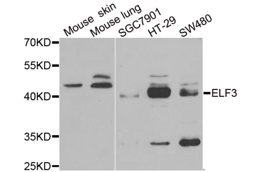Western blot - ELF3 antibody from Signalway Antibody (38856) - Antibodies.com