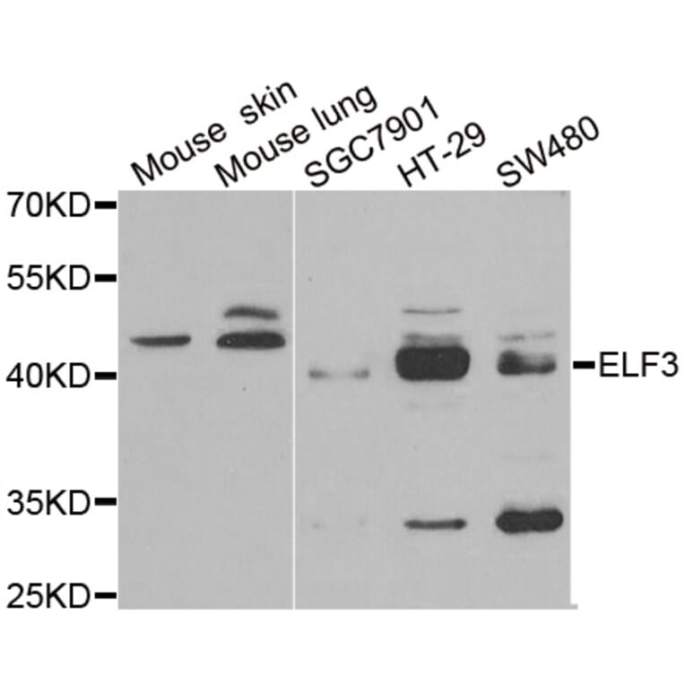 Western blot - ELF3 antibody from Signalway Antibody (38856) - Antibodies.com