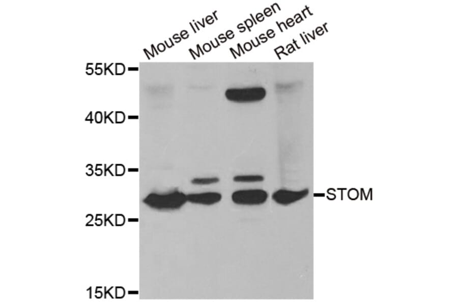 Western blot - STOM antibody from Signalway Antibody (38857) - Antibodies.com