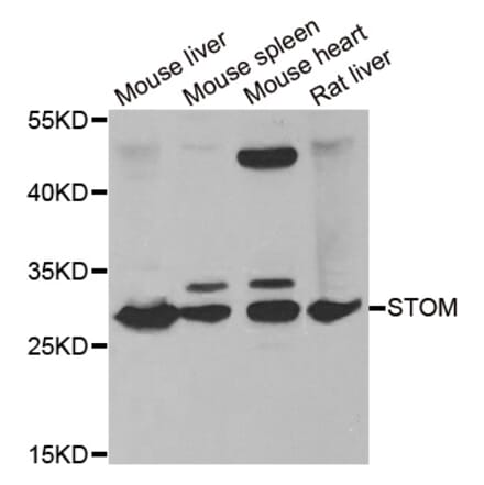 Western blot - STOM antibody from Signalway Antibody (38857) - Antibodies.com
