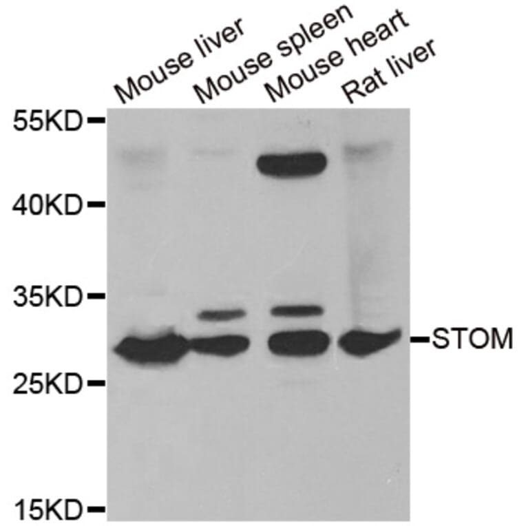 Western blot - STOM antibody from Signalway Antibody (38857) - Antibodies.com