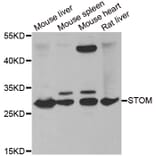 Western blot - STOM antibody from Signalway Antibody (38857) - Antibodies.com