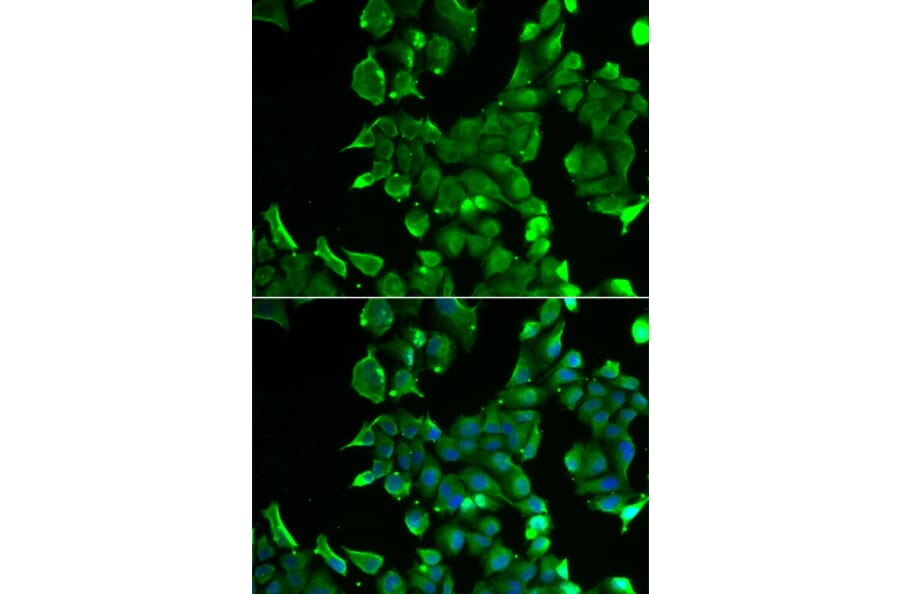 Immunofluorescence - STOM antibody from Signalway Antibody (38857) - Antibodies.com