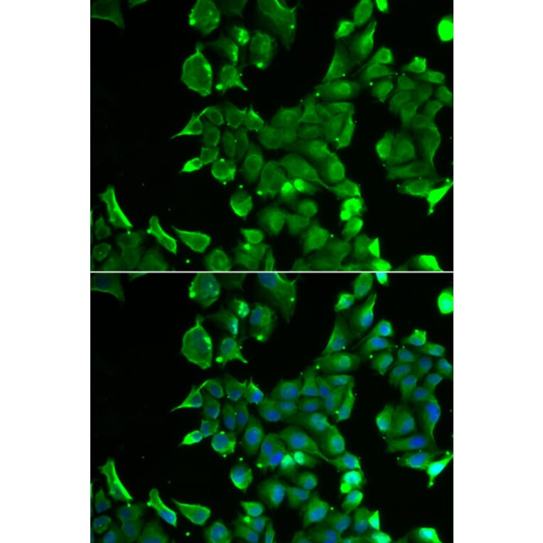 Immunofluorescence - STOM antibody from Signalway Antibody (38857) - Antibodies.com