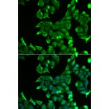 Immunofluorescence - STOM antibody from Signalway Antibody (38857) - Antibodies.com