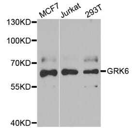 Western blot - GRK6 antibody from Signalway Antibody (38862) - Antibodies.com